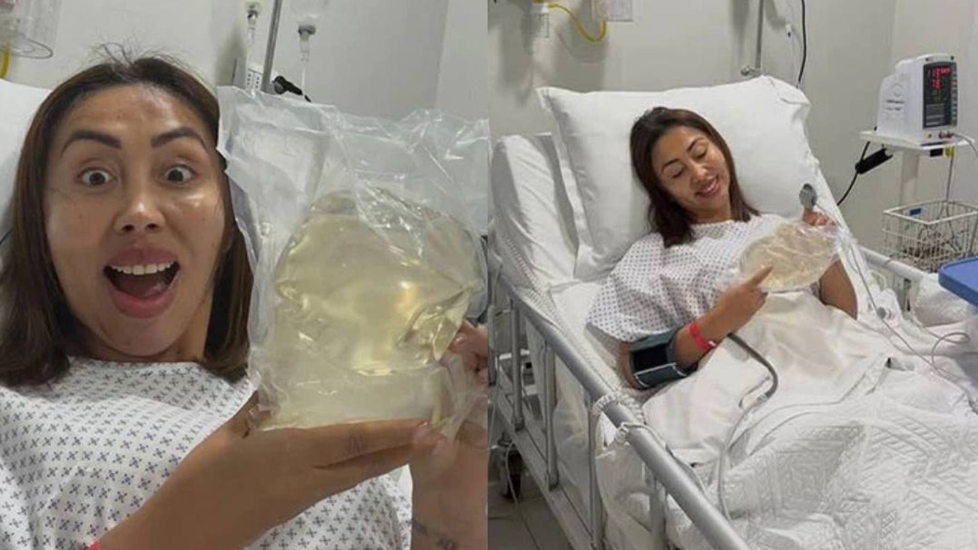 “Me acomplejaban”: Naya Fácil impacta al revelar que redujo sus implantes mamarios