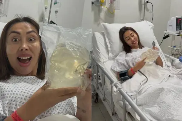Naya Fácil se redujo los implantes mamarios  ,Naya Fácil | Instagram