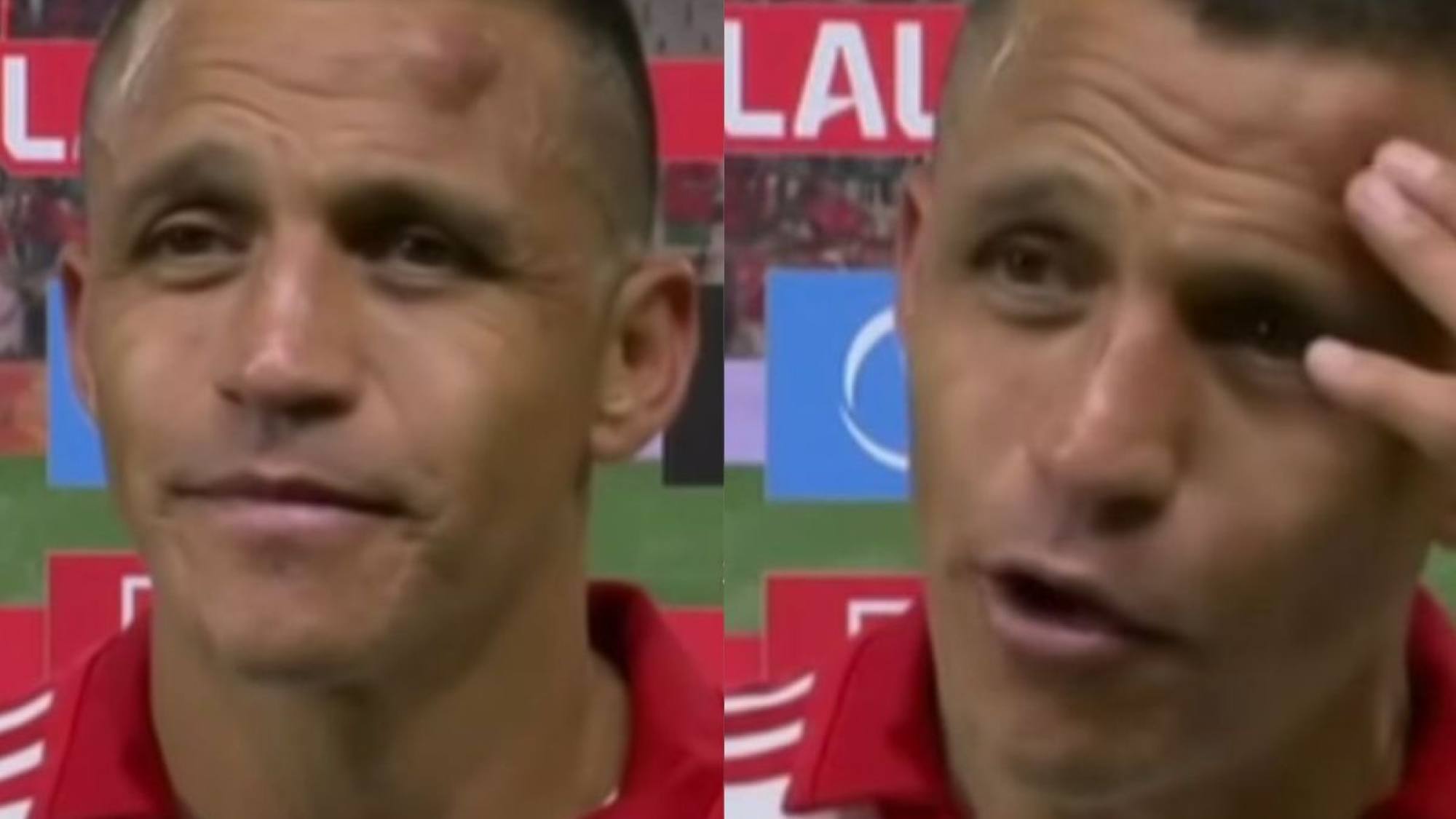 “Estaba mareado”: Alexis Sánchez terminó herido de guerra tras darle vida al Sevilla en España