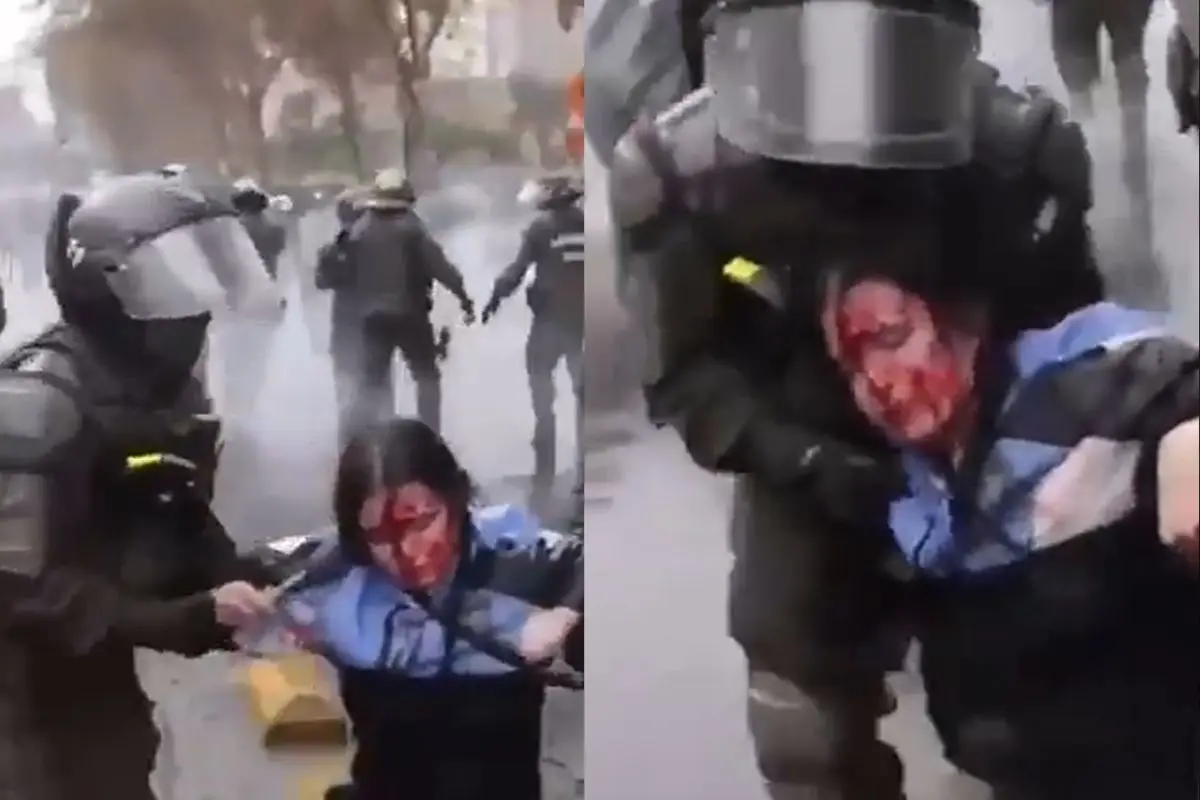 La estudiante tuvo que ser intervenida de urgencia, Captura