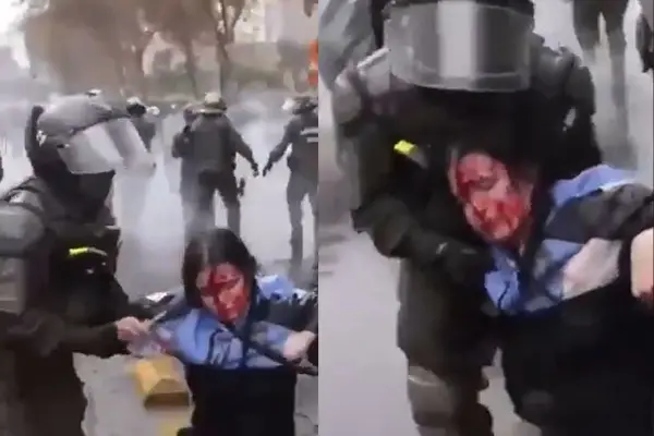 La estudiante tuvo que ser intervenida de urgencia ,Captura