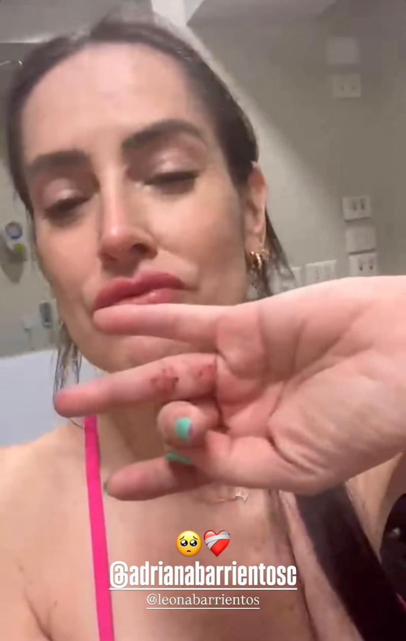 Adriana Barrientos acabó herida - Instagram