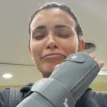 Lesión de Cony Capelli en su muñeca, Captura de Instagram | Cony Capelli