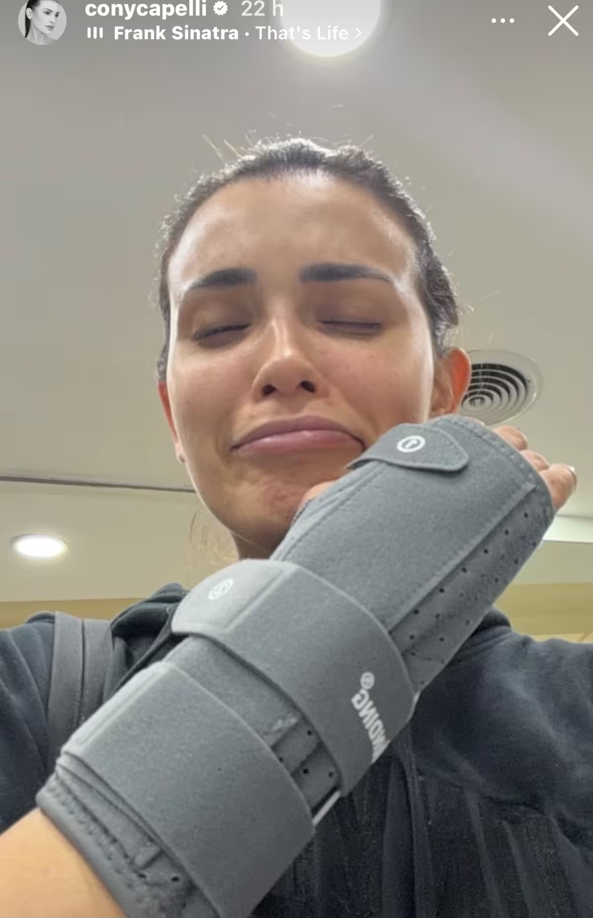 Lesión de Cony Capelli en su muñeca - Captura de Instagram | Cony Capelli