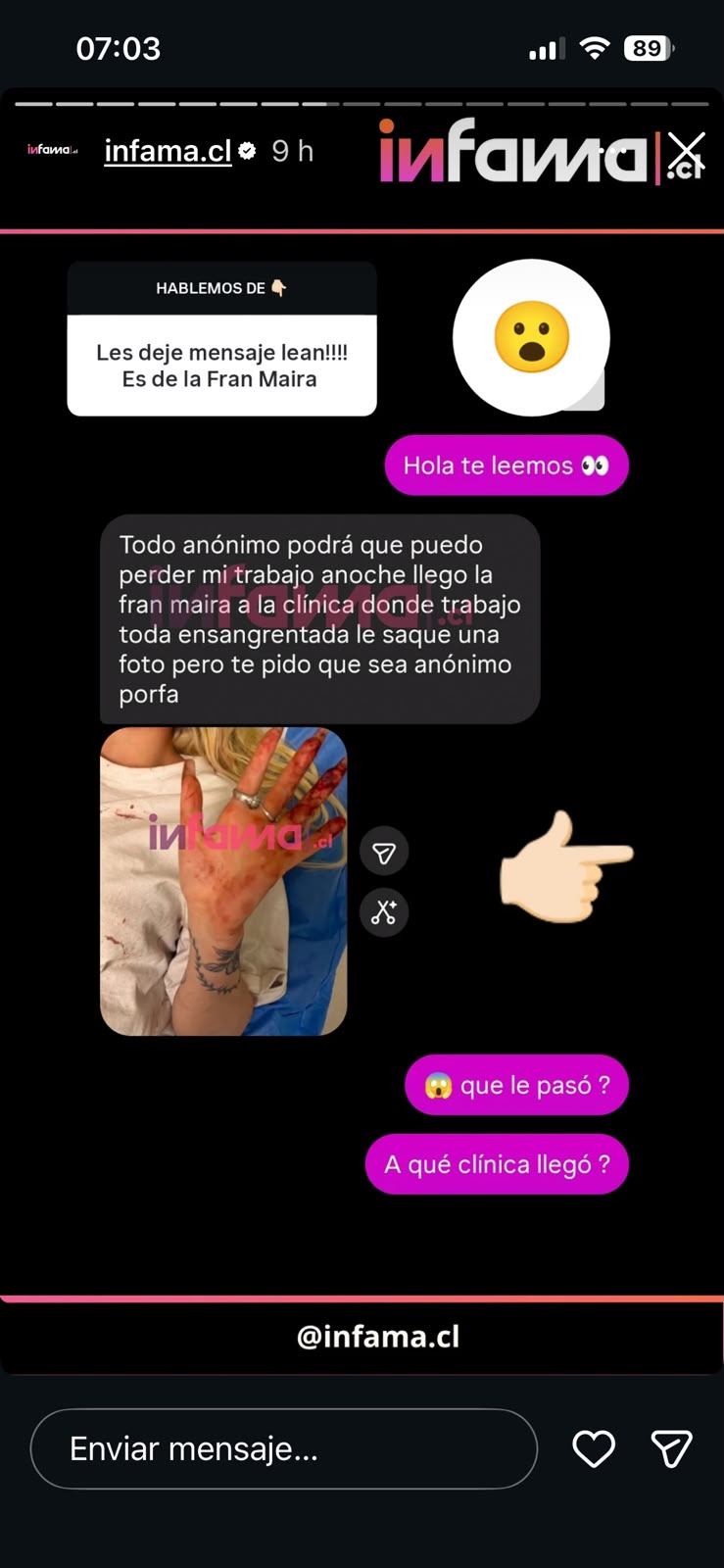 Fran Maira - Instagram (Infama)
