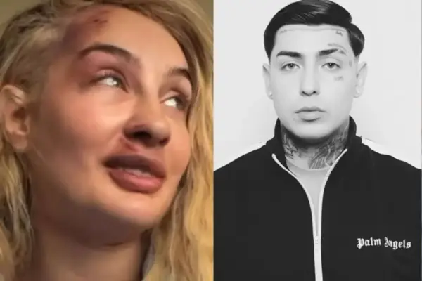 Fran Maira recibió brutal golpiza ,Captura